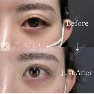 X CLINIC 恵比寿院の症例