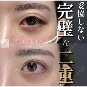 X CLINIC 恵比寿院の症例