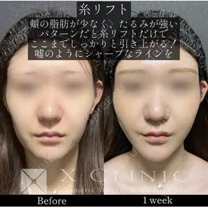 X CLINIC 恵比寿院の症例