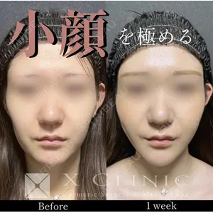 X CLINIC 恵比寿院の症例