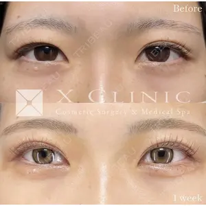 X CLINIC 恵比寿院の症例