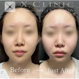 X CLINIC 恵比寿院の症例