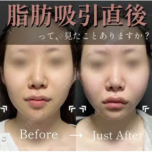X CLINIC 恵比寿院の症例