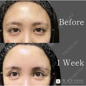 X CLINIC 恵比寿院の症例