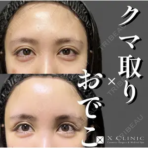 X CLINIC 恵比寿院の症例