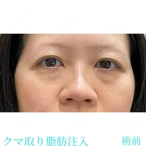 お茶の水美容形成クリニック 吉井 健吾医師の症例