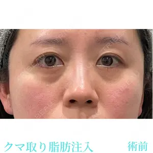 お茶の水美容形成クリニック 吉井 健吾医師の症例