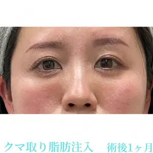 お茶の水美容形成クリニック 吉井 健吾医師の症例
