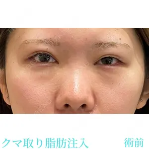 お茶の水美容形成クリニック 吉井 健吾医師の症例