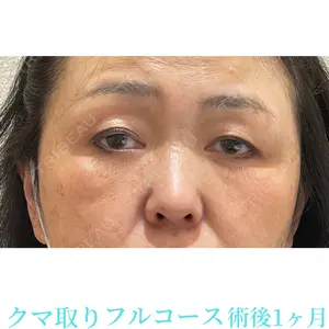 お茶の水美容形成クリニック 吉井 健吾医師の症例