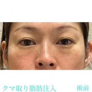 お茶の水美容形成クリニック 吉井 健吾医師の症例