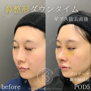 KARIS beauty clinic 滝内 ヒロフミ医師の症例