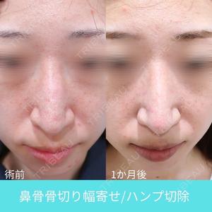 WOM CLINIC GINZA （ワム クリニック ギンザ） 佐々木 和司医師の症例