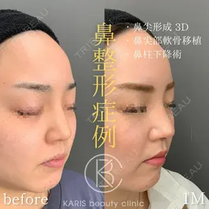 KARIS beauty clinic 滝内 ヒロフミ医師の症例