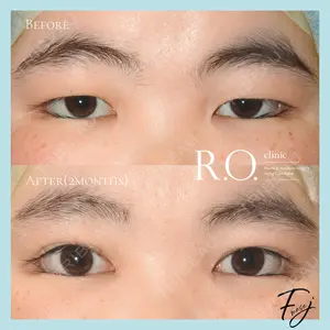 R.O.clinicの症例