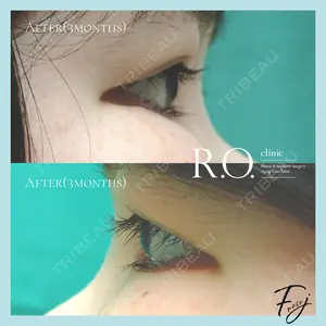R.O.clinicの症例