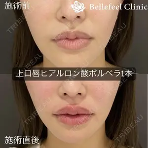 Bellefeel Clinic 代官山の症例