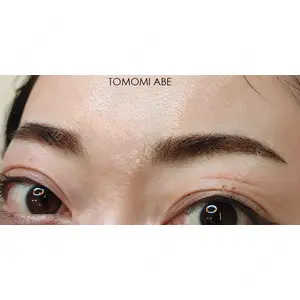 東京イセアクリニック 阿部 友美医師の症例