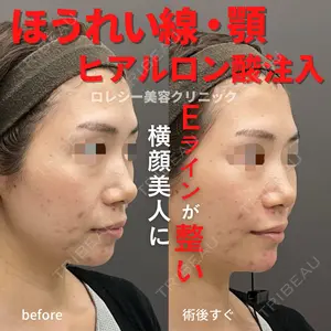 ロレシー美容クリニック 心斎橋駅前院 高田先生医師の症例