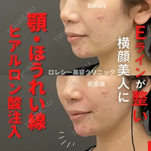 ロレシー美容クリニック 心斎橋駅前院 高田先生医師の症例