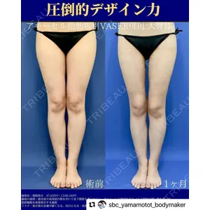 湘南美容クリニック 名古屋院 山本 高士医師の症例