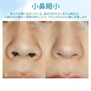 聖心美容クリニック 札幌院 前多 一彦医師の症例
