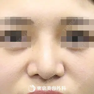 東京美容外科 青森院の症例