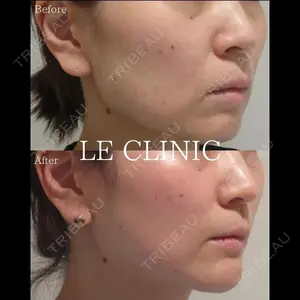 LE CLINICの症例