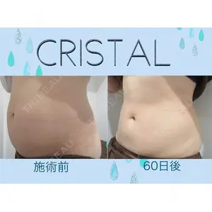 LE CLINICの症例