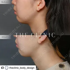 THE CLINIC（ザ・クリニック） 東京院の症例