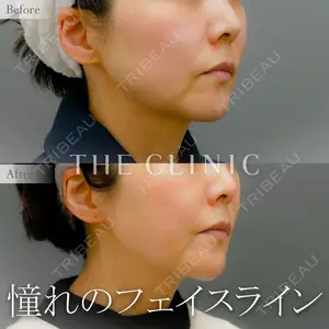THE CLINIC（ザ・クリニック） 広島院 木村 圭吾医師の症例