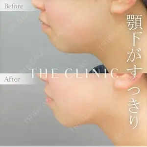 THE CLINIC（ザ・クリニック） 広島院 木村 圭吾医師の症例