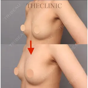 THE CLINIC（ザ・クリニック） 東京院 村田 八千穂医師の症例