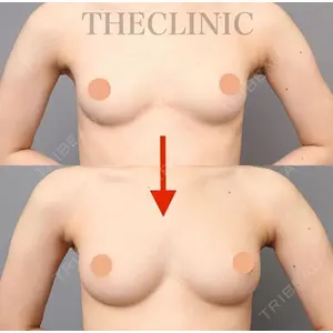THE CLINIC（ザ・クリニック） 東京院 村田 八千穂医師の症例