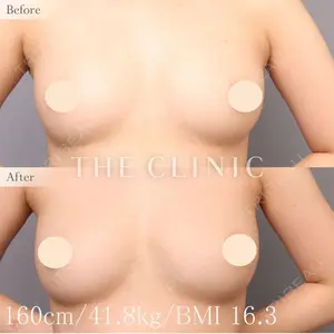 THE CLINIC（ザ・クリニック） 東京院 村田 八千穂医師の症例