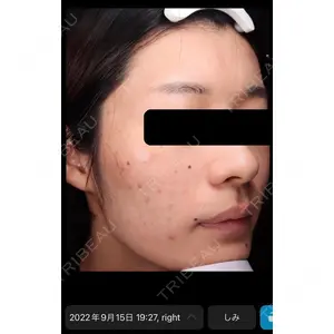 DMTC美容皮膚科 日本橋院の症例