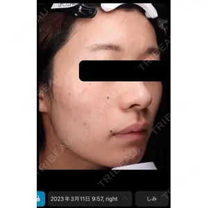 DMTC美容皮膚科 日本橋院の症例