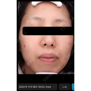 DMTC美容皮膚科 日本橋院の症例