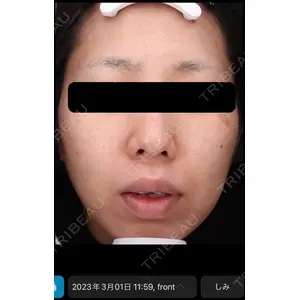 DMTC美容皮膚科 日本橋院の症例