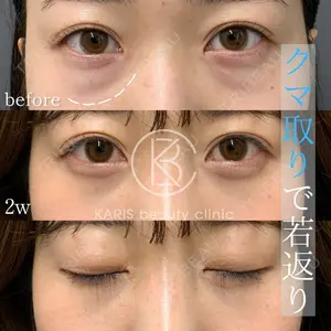 KARIS beauty clinicの症例