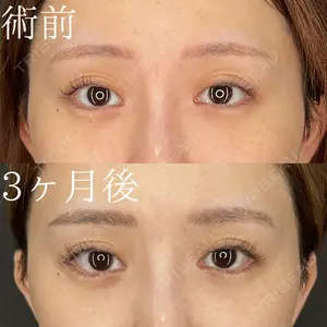 HAAB×DREAM BEAUTY CLINIC 大阪梅田院 鈴木 馨斗医師の症例