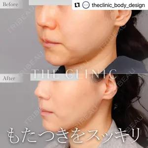 THE CLINIC（ザ・クリニック） 名古屋院 今西 理也医師の症例