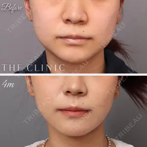 THE CLINIC（ザ・クリニック） 名古屋院 今西 理也医師の症例