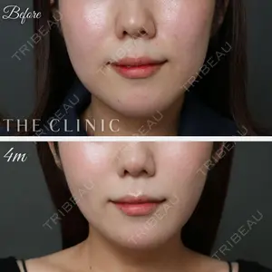 THE CLINIC（ザ・クリニック） 名古屋院 今西 理也医師の症例