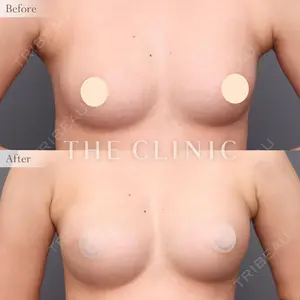 THE CLINIC（ザ・クリニック） 東京院 帯包 雄次郎医師の症例