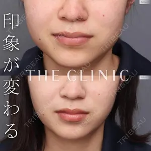 THE CLINIC（ザ・クリニック） 東京院 帯包 雄次郎医師の症例