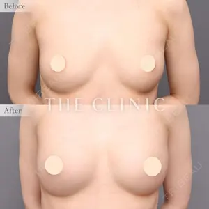 THE CLINIC（ザ・クリニック） 東京院 帯包 雄次郎医師の症例