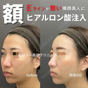 ロレシー美容クリニック 心斎橋駅前院 福留院長医師の症例