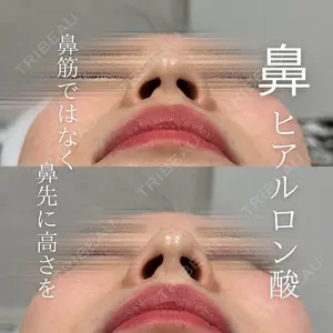 X CLINIC 福岡天神院 倉光　瞳医師の症例