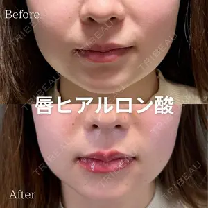X CLINIC 福岡天神院 松岡　幸医師の症例